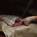 ΣΦΥΡΊΔΑ ΣΕ ΦΕΤΕΣ